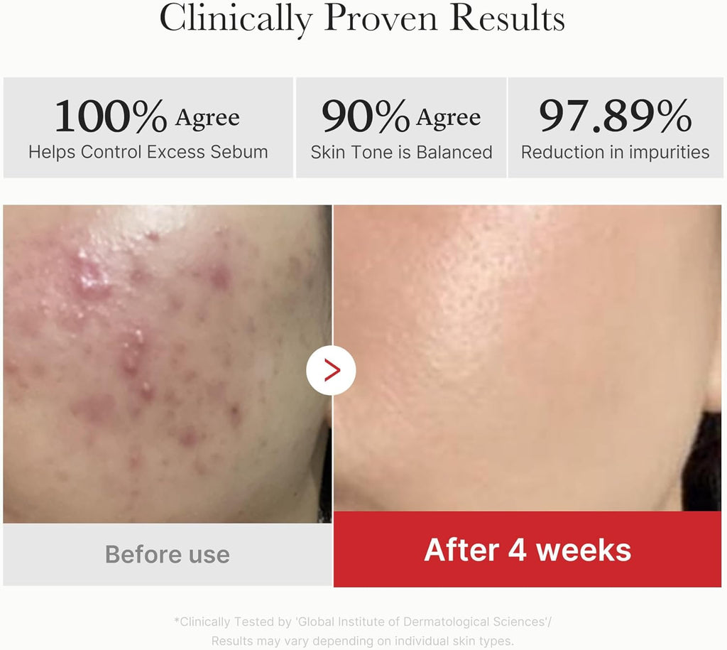 Medicube Zero Pore Pads 2.0, Dual-Textured Facial Toner Pads for Exfoliation and Pore Care with 4.5% AHA Lactic Acid & 0.45% BHA Salicylic Acid, Ideal for All Skin Types, Korean Skin Care (70 units)