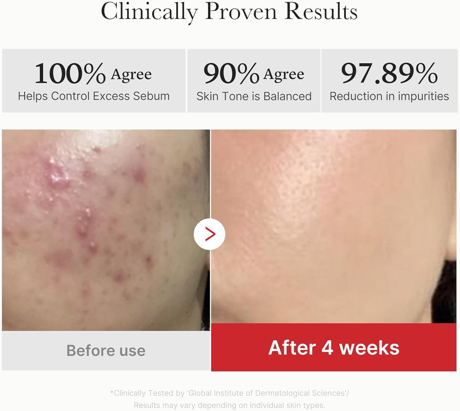 Medicube Zero Pore Pads 2.0, Dual-Textured Facial Toner Pads for Exfoliation and Pore Care with 4.5% AHA Lactic Acid & 0.45% BHA Salicylic Acid, Ideal for All Skin Types, Korean Skin Care (70 units)