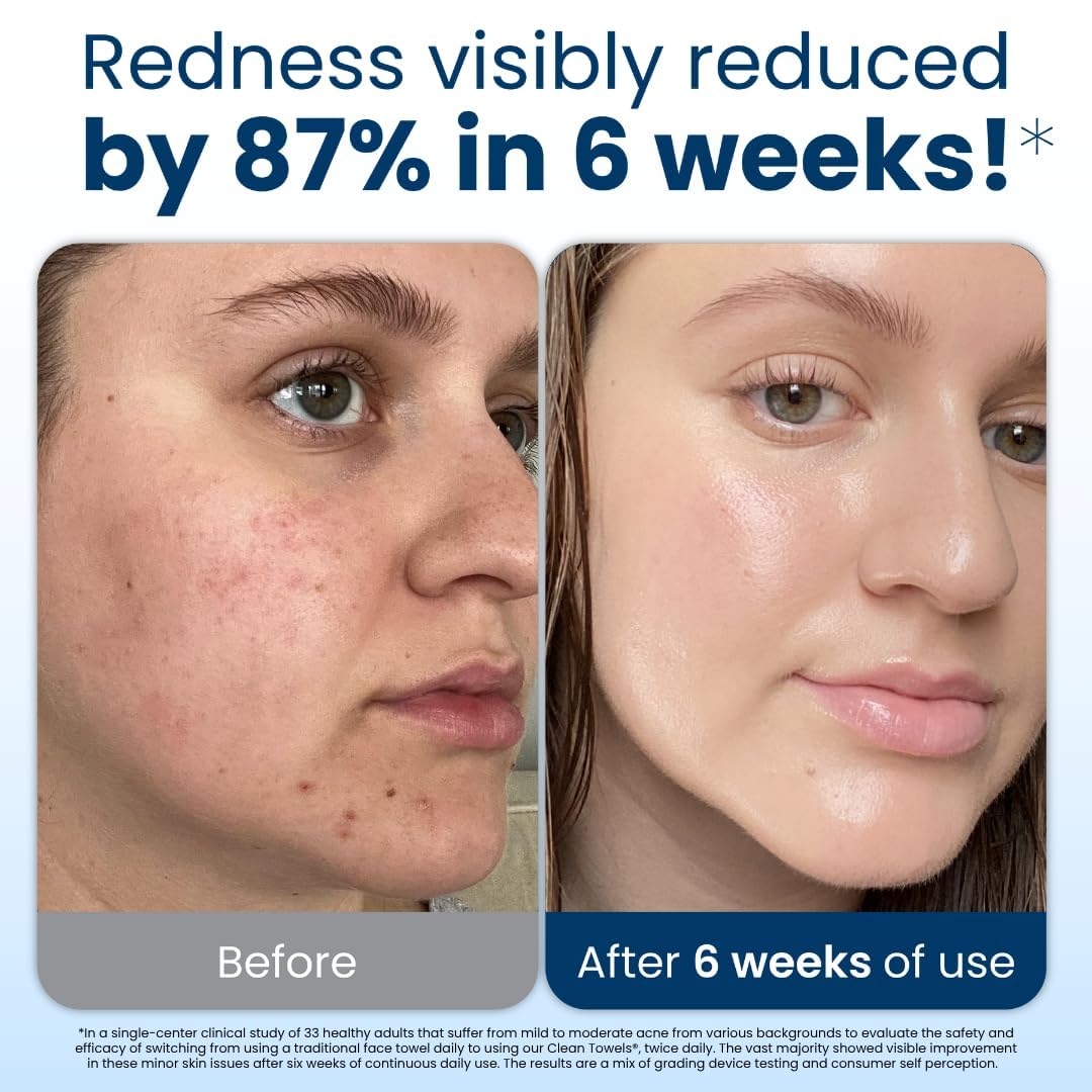 Clean Skin Club Clean Towels XL, 100% USDA Biobased Face Towel, Disposable Face Towelette, Eczema Association Accepted, Makeup Remover Dry Wipes, Ultra Soft, 1 Pack, 50 Ct