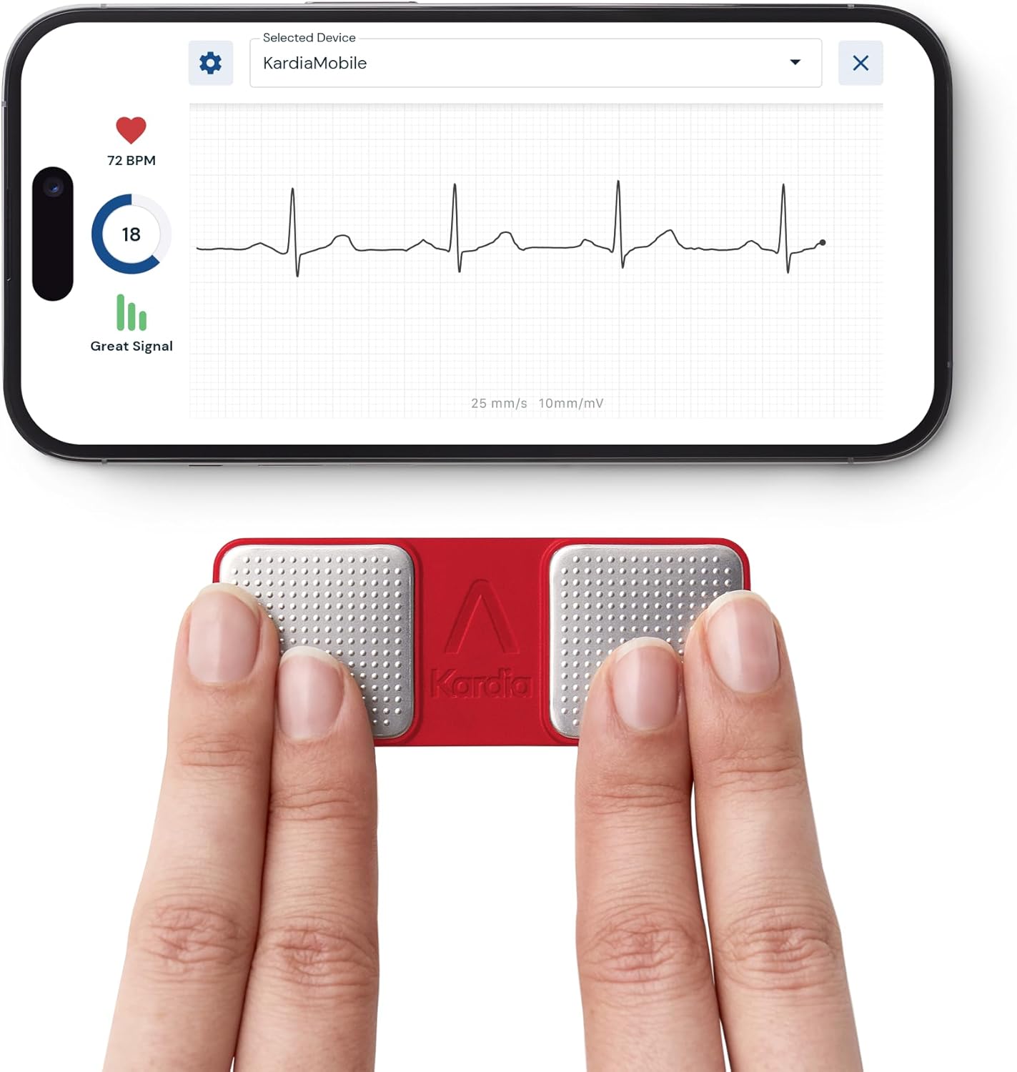 KardiaMobile 1-Lead Personal EKG Monitor – Record at Home – Detects AFib & Irregular Arrhythmias – Easy Results in 30 Seconds – Works w/Most Smartphones