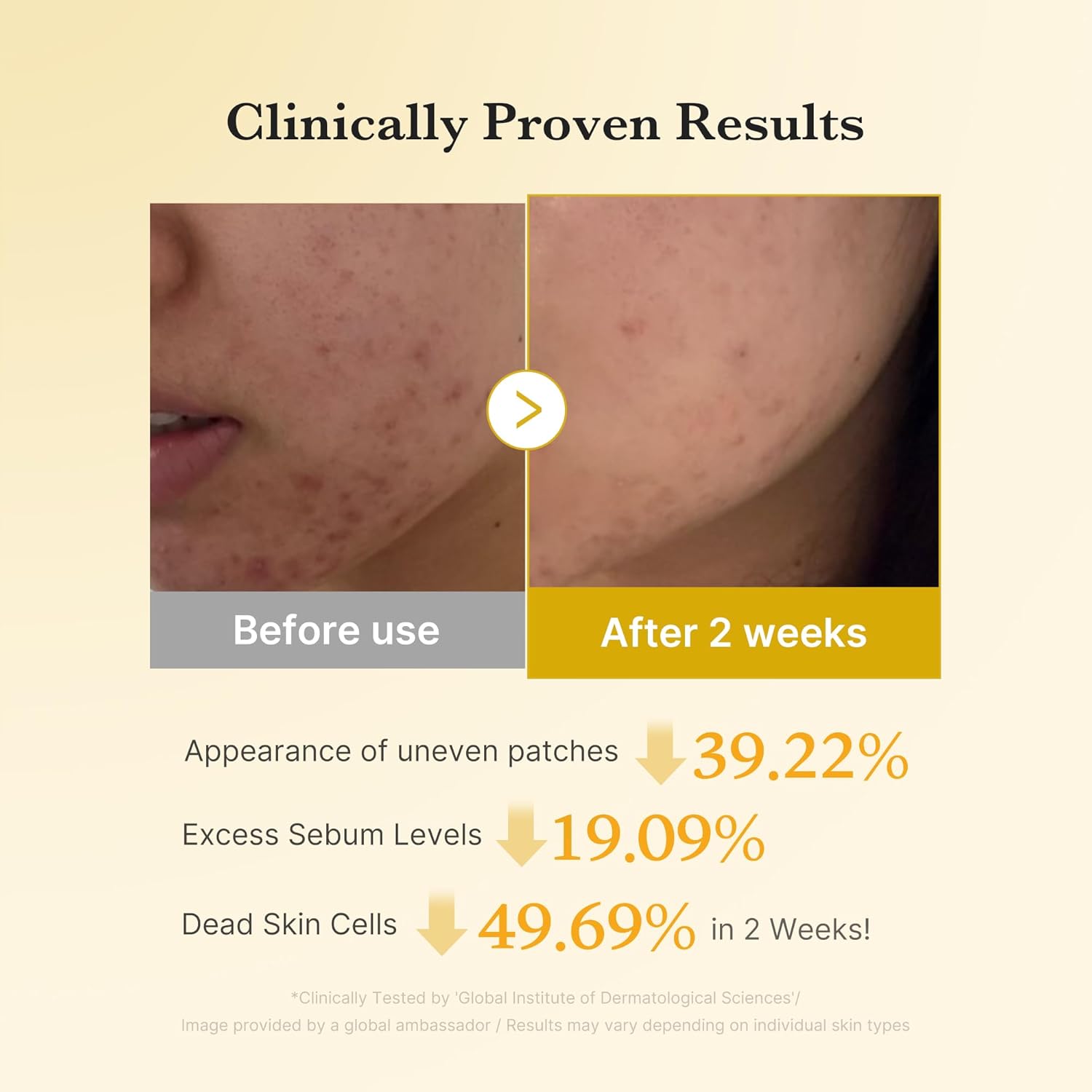 Medicube Zero Pore Pads 2.0, Dual-Textured Facial Toner Pads for Exfoliation and Pore Care with 4.5% AHA Lactic Acid & 0.45% BHA Salicylic Acid, Ideal for All Skin Types, Korean Skin Care (70 units)