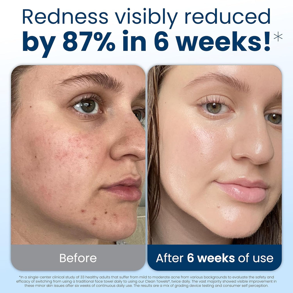 Clean Skin Club Clean Towels XL, 100% USDA Biobased Face Towel, Disposable Face Towelette, Eczema Association Accepted, Makeup Remover Dry Wipes, Ultra Soft, 1 Pack, 50 Ct